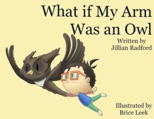 What if my Arm was an Owl?